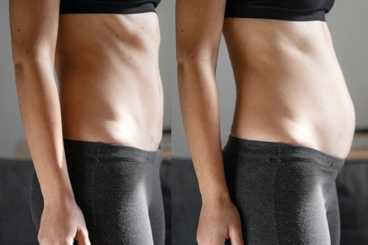 How long does diastasis recti take to improve Knightsbridge?