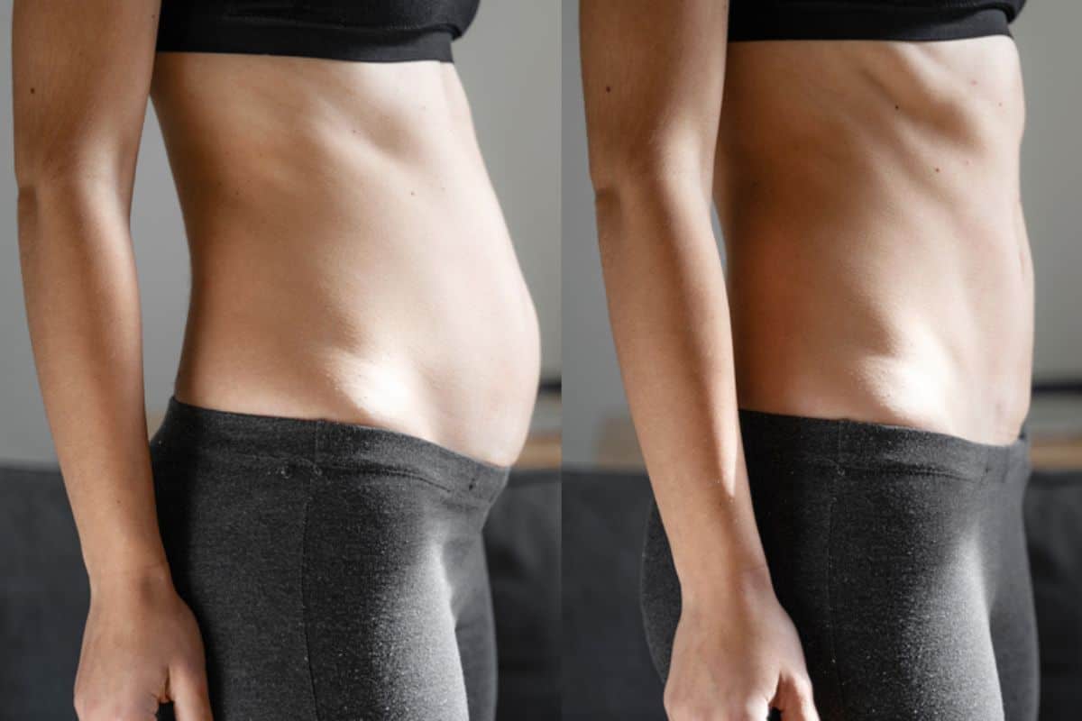 Post-Pregnancy: What Happens to Your Abdominal Muscles After Birth Knightsbridge