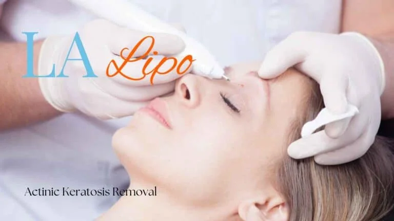 Woman receiving Actinic Keratosis Removal Treatment Knightsbridge