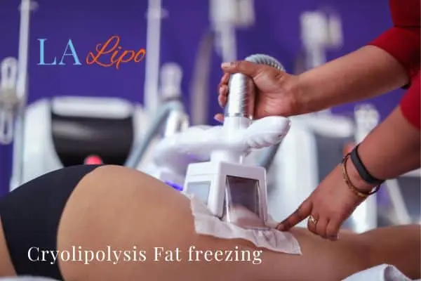 women getting fat freezing Knightsbridge
