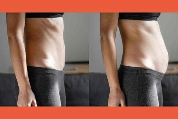 LA-EMS Body Sculpting results Knightsbridge