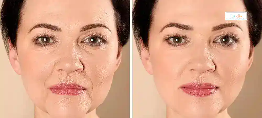 Why Aren’t My Skincare Products Making My Sagging Skin Look Firmer Knightsbridge?